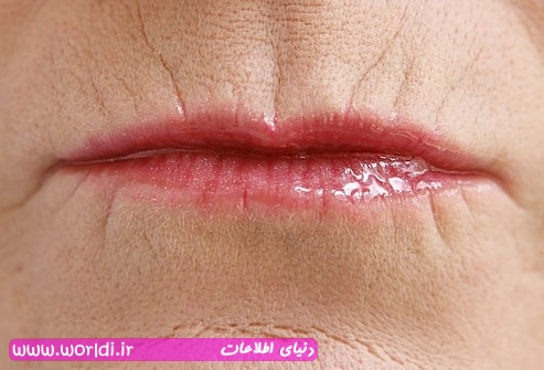 چروک دور لب