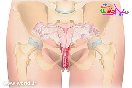 تنگ کردن واژن