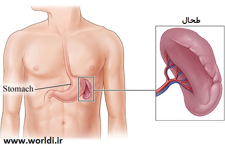 بدون طحال می توان زندگی کرد؟