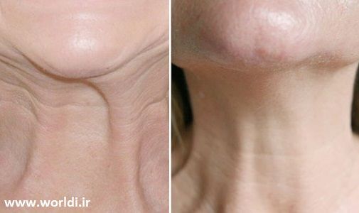 javan sazi pooste gardan