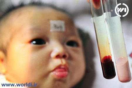 نوزادی که خونش صورتی رنگ است