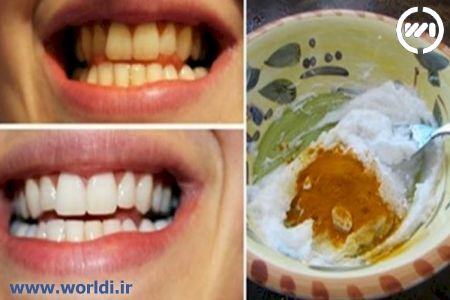 بلیچینگ طبیعی