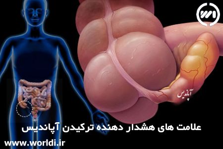 علامت های هشدار دهنده ترکیدن آپاندیس