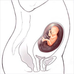 هفته 17 ام بارداری