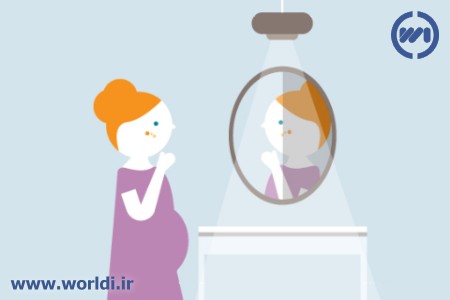 جوش بارداری