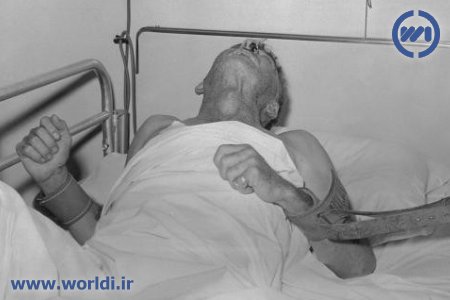 یک بیمار هار در سال ۱۹۵۹