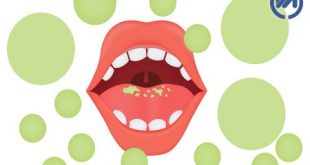 یوی بد دهان