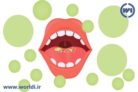 یوی بد دهان