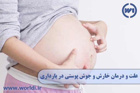 PUPPP Rash During Pregnancy