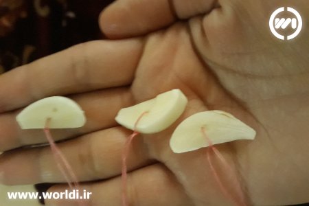 روش های درمان عفونت واژن با سیر