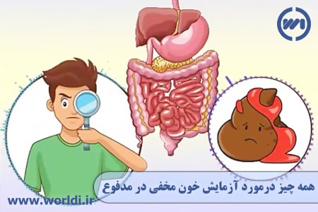 آزمایش خون مخفی در مدفوع