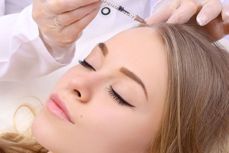 فیلر مو یا مزوتراپی