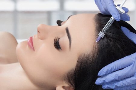 مزوتراپی مو