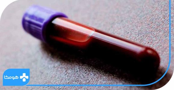 آزمایش کم خونی در منزل