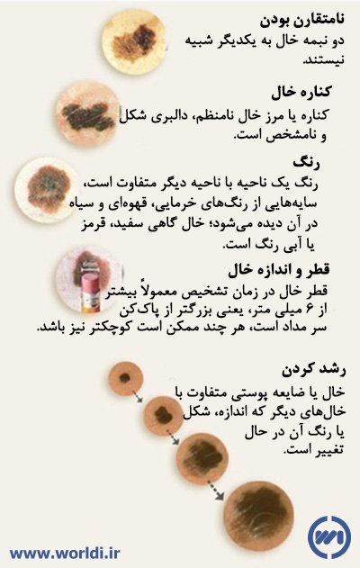 آشنایی مقدماتی با ملانوم